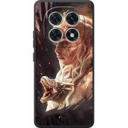 Чохол BoxFace Poco M8 