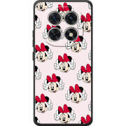 Чохол BoxFace Poco M8 