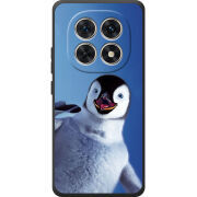 Чохол BoxFace Poco M8 