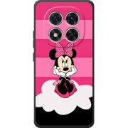 Чохол BoxFace Poco M8 Pro 