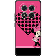 Чохол BoxFace Poco M8 Pro 