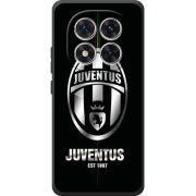 Чохол BoxFace Poco M8 Pro 