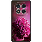 Чохол BoxFace Poco M8 Pro 