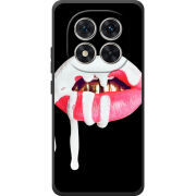 Чохол BoxFace Poco M8 Pro 