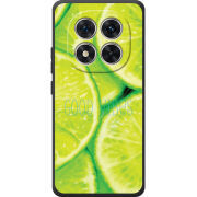 Чохол BoxFace Poco M8 Pro 