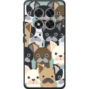 Чохол BoxFace Poco M8 Pro 