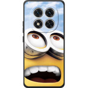 Чохол BoxFace Poco M8 Pro 