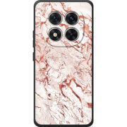 Чохол BoxFace Poco M8 Pro 