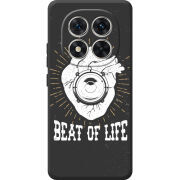 Чохол BoxFace Poco M8 Pro 