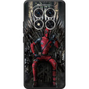 Чохол BoxFace Poco M8 Pro 