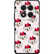 Чохол BoxFace Poco M8 Pro 