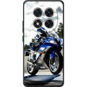 Чохол BoxFace Poco M8 Pro 