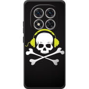 Чохол BoxFace Poco M8 Pro 