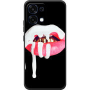 Чохол BoxFace OPPO A6 Pro 