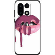 Чохол BoxFace OnePlus 15 