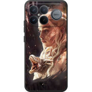 Чохол BoxFace Poco F8 Ultra 