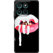 Чохол BoxFace Moto G57 Power 