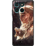 Чохол BoxFace Moto G57 Power 