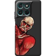 Чорний чохол BoxFace Moto G57 Power Титан