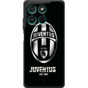 Чохол BoxFace Moto G86 Power 