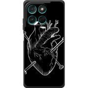 Чохол BoxFace Moto G86 Power 