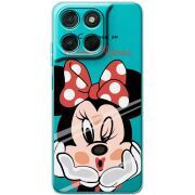 Прозорий чохол BoxFace Moto G86 Power Lady M