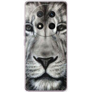 Чохол BoxFace Honor X9c 