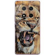 Чохол BoxFace Honor X9c 