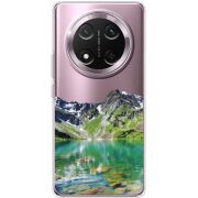 Прозорий чохол BoxFace Honor X9c Green Mountain