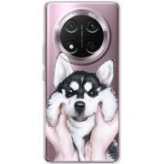 Прозорий чохол BoxFace Honor X9c Husky