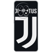 Чохол BoxFace OnePlus Ace 5 FC J