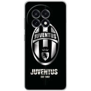 Чохол BoxFace OnePlus Ace 5 