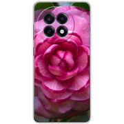 Чохол BoxFace OnePlus Ace 5 