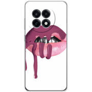 Чохол BoxFace OnePlus Ace 5 