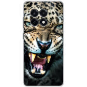 Чохол BoxFace OnePlus Ace 5 