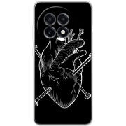 Чохол BoxFace OnePlus Ace 5 