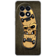 Чохол BoxFace OnePlus Ace 5 