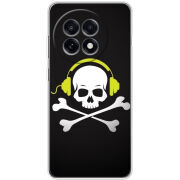 Чохол BoxFace OnePlus Ace 5 