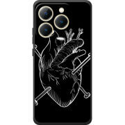 Чохол BoxFace Realme 15T 