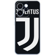 Чохол BoxFace OPPO Reno 15 Pro FC J