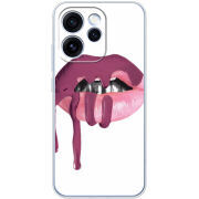 Чохол BoxFace OPPO Reno 15 Pro 