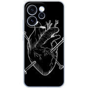 Чохол BoxFace OPPO Reno 15 Pro 