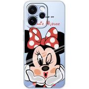 Прозорий чохол BoxFace OPPO Reno 15 Pro Lady M