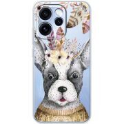 Прозорий чохол BoxFace OPPO Reno 15 Pro 