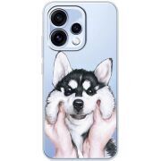 Прозорий чохол BoxFace OPPO Reno 15 Husky