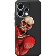 Чорний чохол BoxFace OPPO Reno 15 Титан