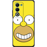 Чохол BoxFace OPPO A5 