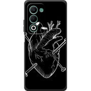 Чохол BoxFace OPPO A5m 