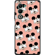 Чохол BoxFace OPPO A5m 