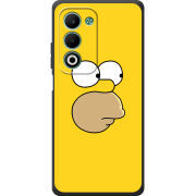 Чохол BoxFace OPPO A5m 